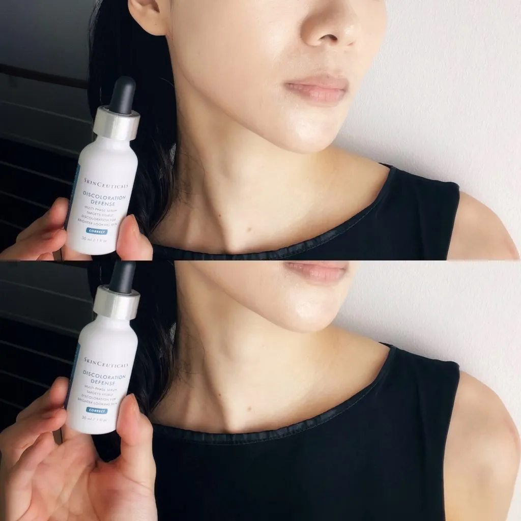 Best skincare ingredients for hyperpigmentation on face - SkinCeuticals Discoloration Defense